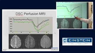 Introducing MRI Perfusion Imaging 53 of 56 [upl. by Materi]