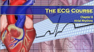 Premature Atrial Contractions PACs Animation [upl. by Nuhsyar]