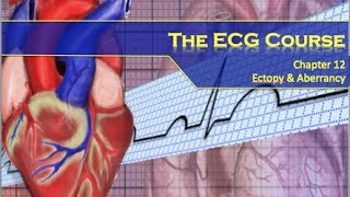 The ECG Course  Ectopy amp Aberrancy [upl. by Therine]