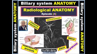 Radiological anatomy episode 4 Biliary system Anatomy [upl. by Lorelei23]