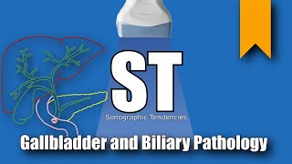 Gallbladder and Biliary Pathology [upl. by Scharaga375]