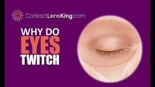 Why Do Eyes Twitch [upl. by Ahsytal]