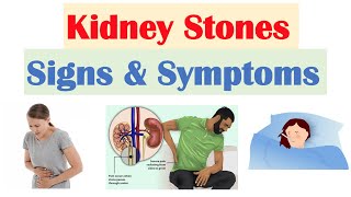 7 most common KIDNEY STONE symptoms  Doctor explains [upl. by Coletta]