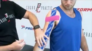 How to Apply PF Performance Tape  Bicep Tendon [upl. by Ignazio609]