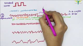 Electroencephalogram EEG  Waves  Physiology [upl. by Alfie]