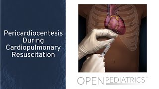 Pericardiocentesis During Cardiopulmonary Resuscitation by T Wolbrink  OPENPediatrics [upl. by Ardnoid]