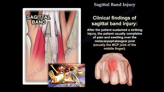 Sagittal Band Injury  Everything You Need To Know  Dr Nabil Ebraheim [upl. by Walke]