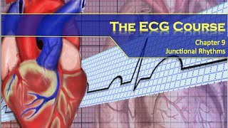 Ablation What to Expect w MikeLitrelMD [upl. by Bander]